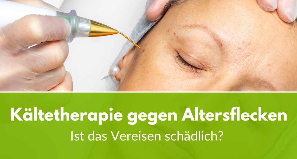Kressesalbe Gegen Altersflecken – Feuchtigkeitsspendende Creme Für Gesicht & Pigmentflecken, 100 Ml