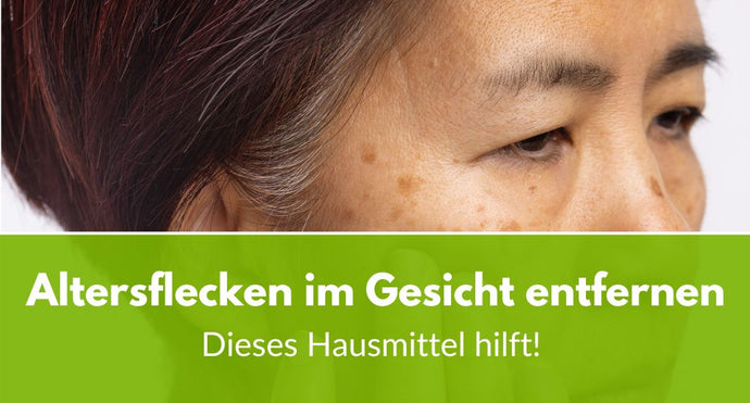 Altersflecken im Gesicht entfernen: Dieses Hausmittel hilft