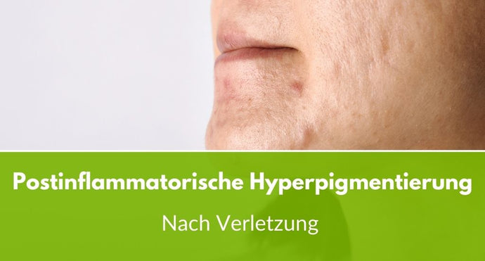 Postinflammatorische Hyperpigmentierung nach Verletzung