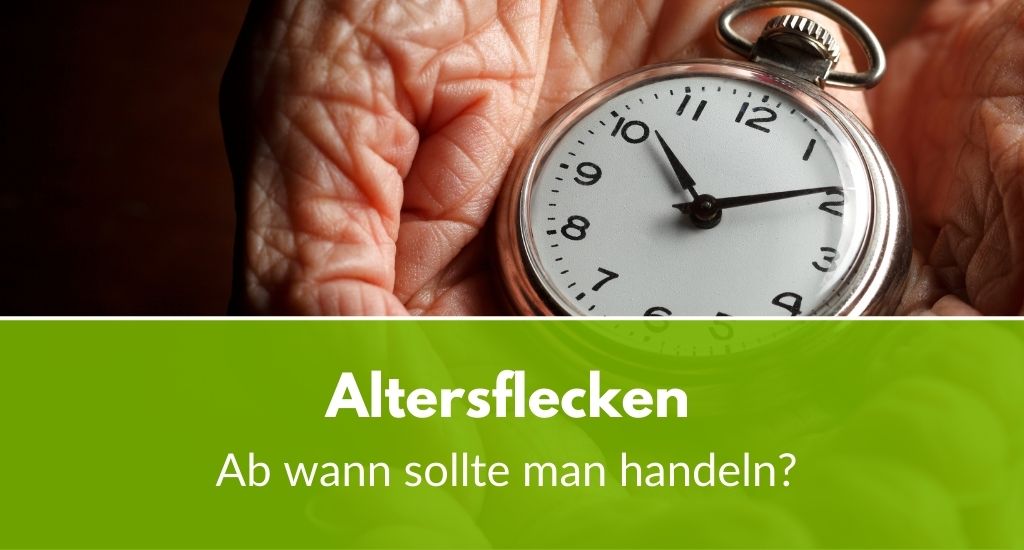 Altersflecken: Ab wann sollte man handeln?