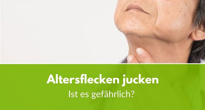 Altersflecken jucken: Ist es gefährlich?