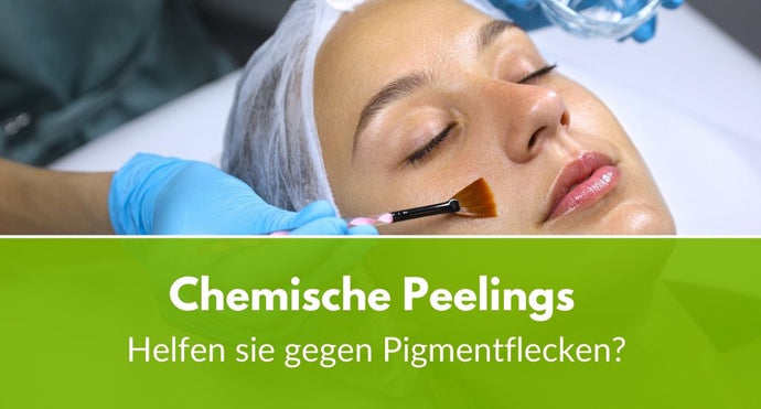Chemische Peelings im Test: Helfen sie gegen Pigmentflecken?