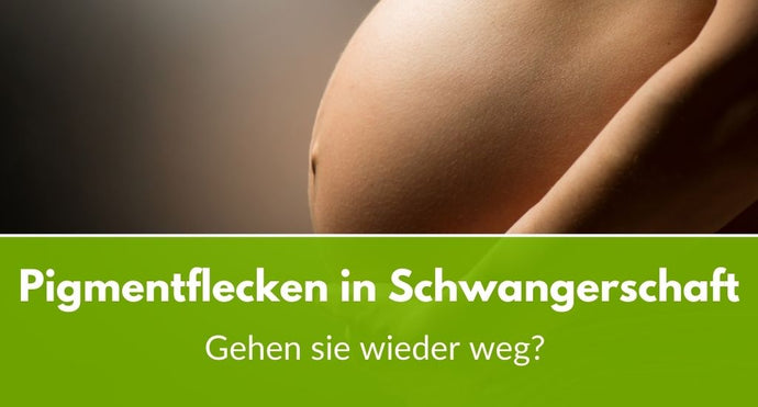 Pigmentflecken in Schwangerschaft: Gehen sie wieder weg?