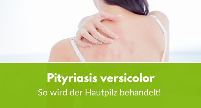 Pityriasis versicolor: So wird der Hautpilz richtig behandelt!