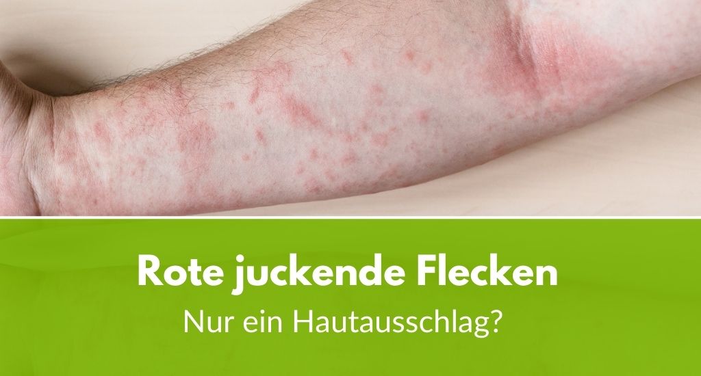 Rote, juckende Flecken: Mehr als nur ein Hautausschlag?