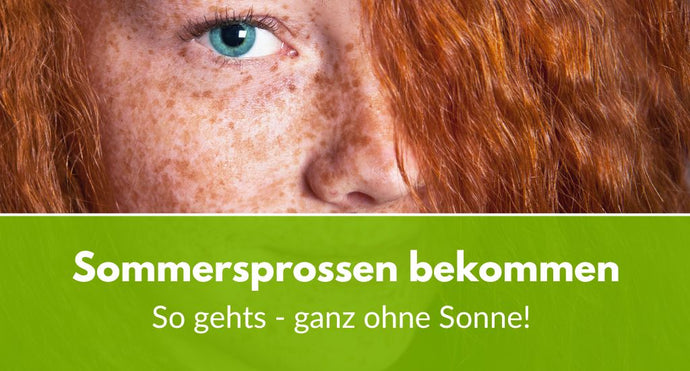 So bekommt man Sommersprossen - auch ohne Sonne!